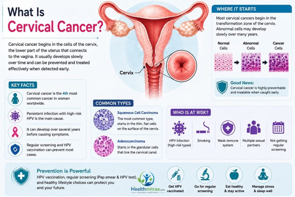 What Is Cervical Cancer? Medical Infographic